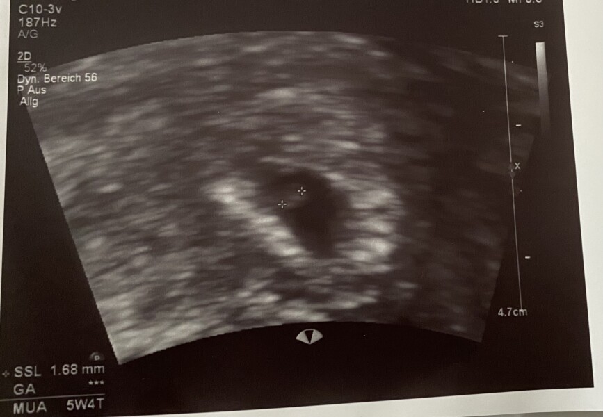 Tracking your cycle and possible BFP using RHR - part 6