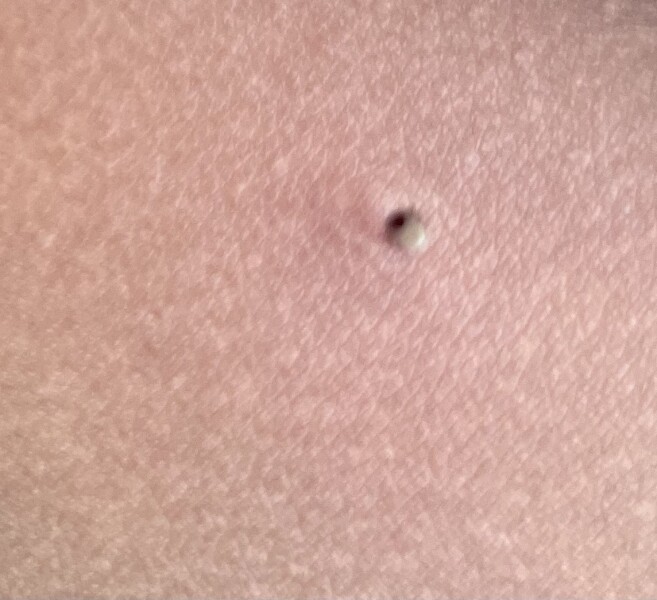 To think this is a tick? (Urgent!!)