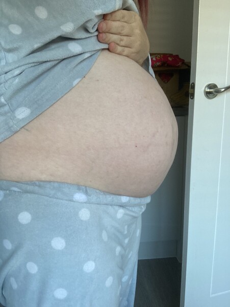 Pregnancy bumps