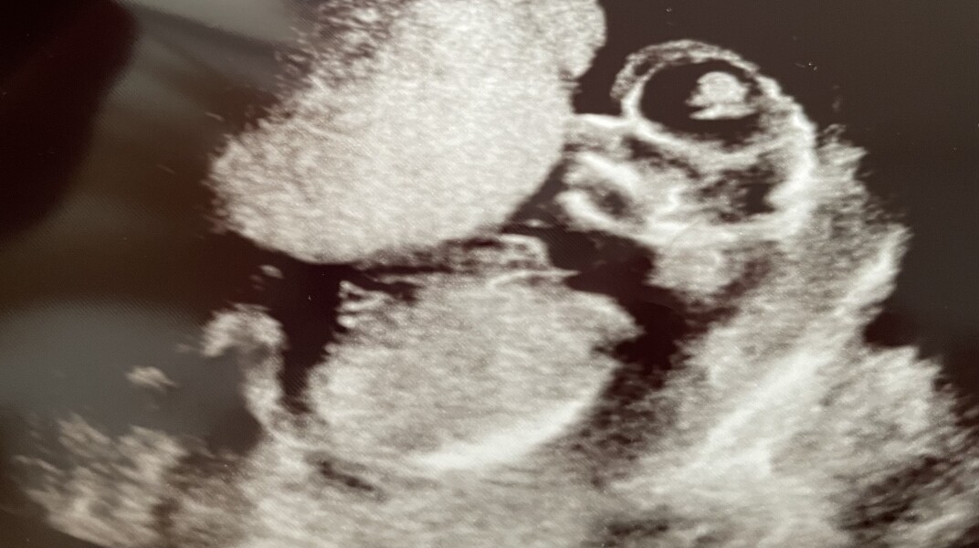 Due December 2022 thread 3