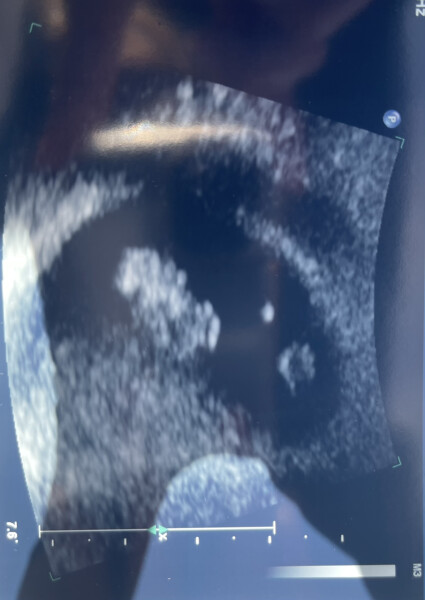 Baby January 2023!