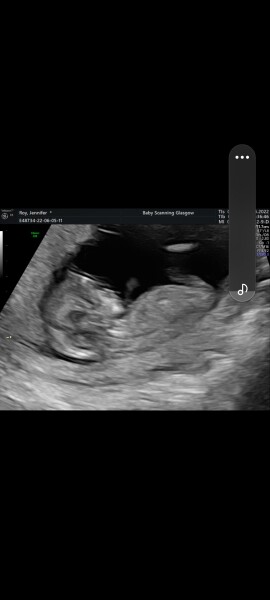 Due Jan 2023
