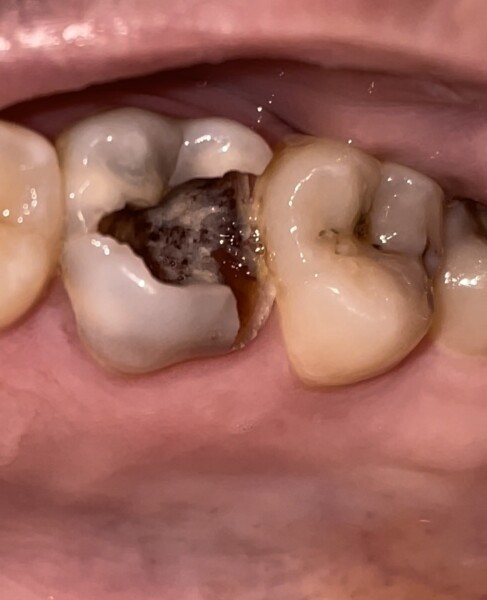 Any dentists/ dental assistants on here?