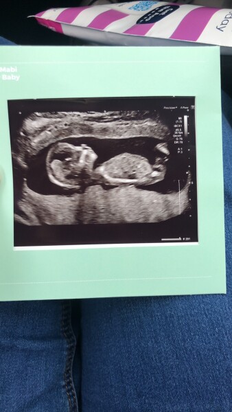 Gender guesses? 13+4