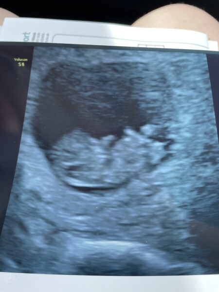 Due January 2023 👶🏼💜