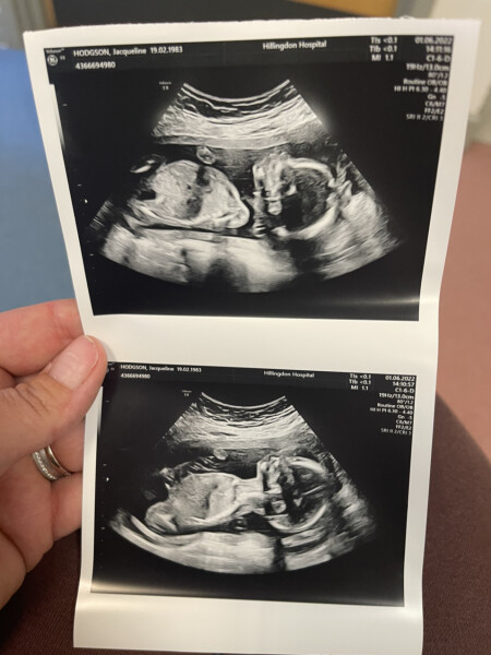 Navigating pregnancy after loss thread 3