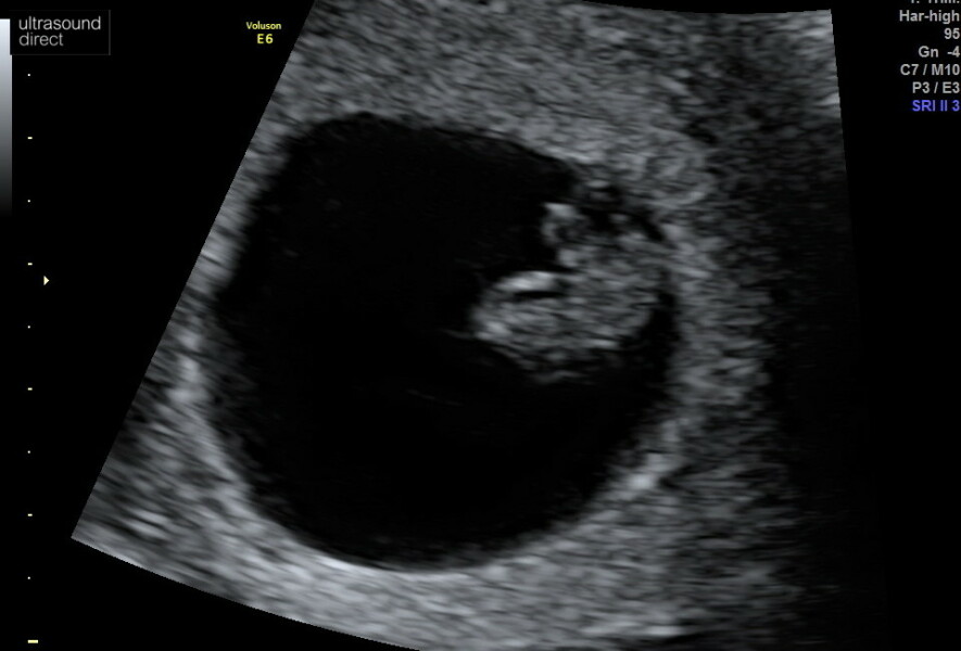 Baby January 2023!