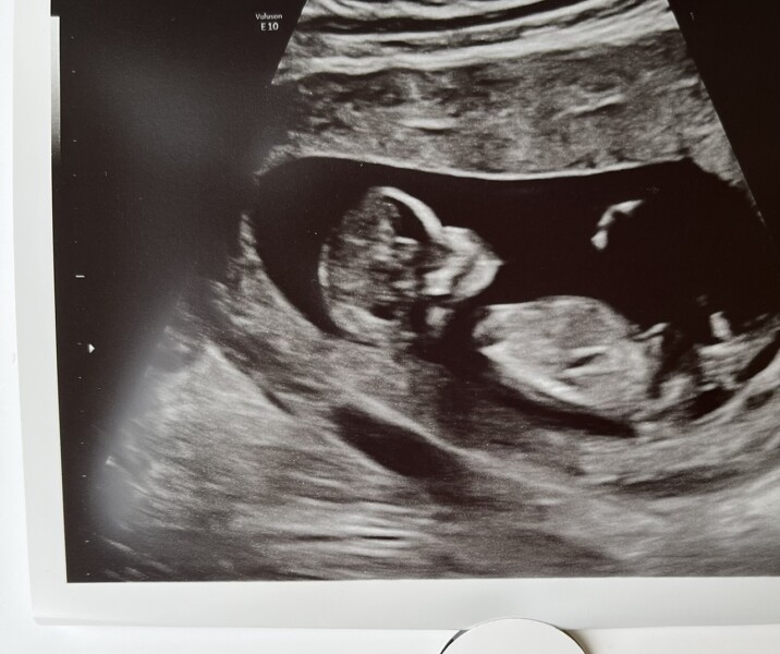 Due December 2022 thread 3