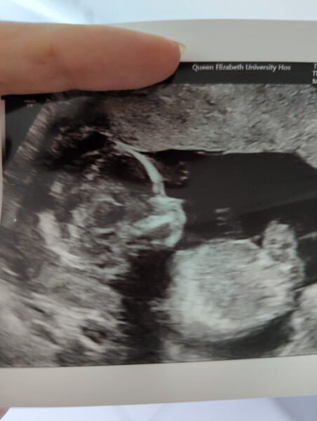 Due December 2022 thread 3