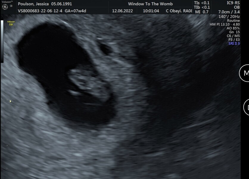 Our little blessing