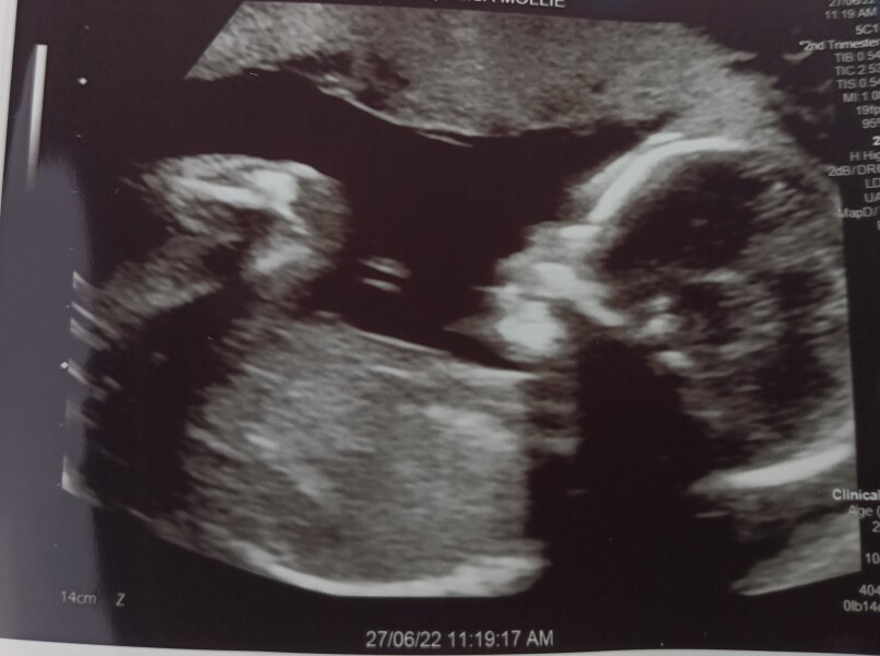Due November 2022 Thread 3