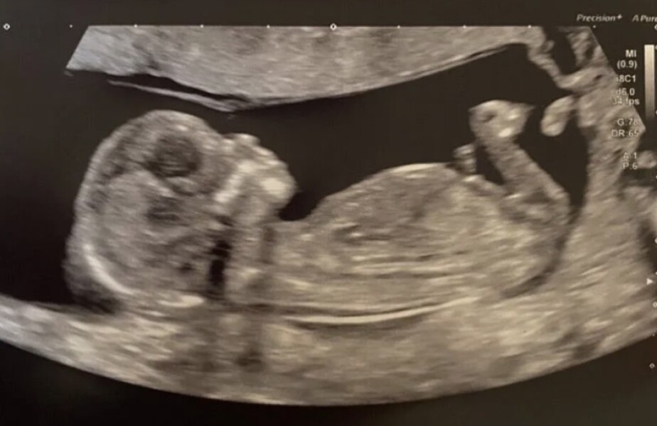 Boy or girl?