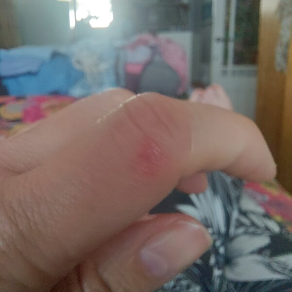 What on earth is biting me? Such pain!