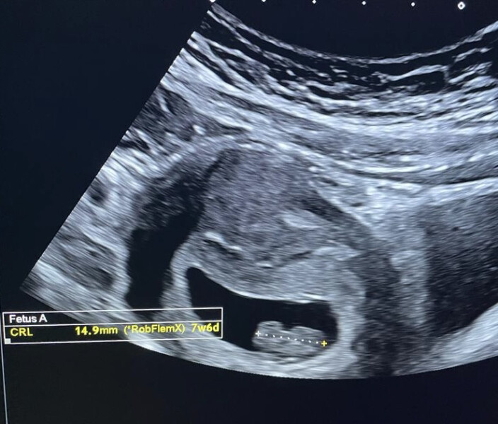 Due Jan 2023