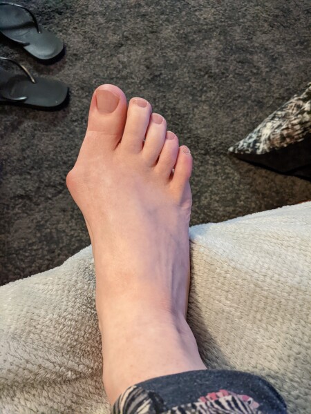 52 and with bloody bad bunions….