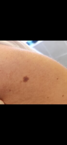 Is this normal?