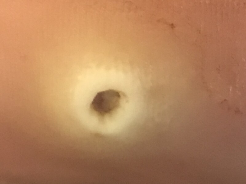 What the hell is this hole in my foot?