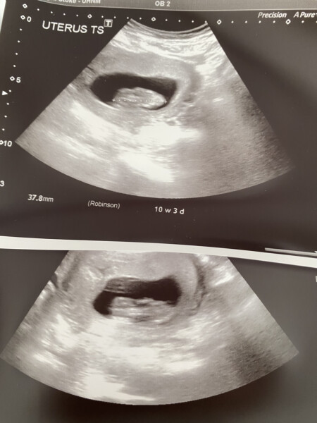 Due December 2022 thread 3
