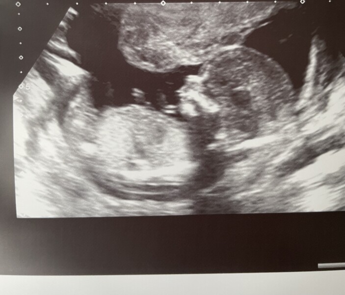 Boy or girl?! 14+1