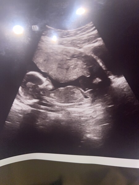Scan- boy 👦 or girl? 👧 
