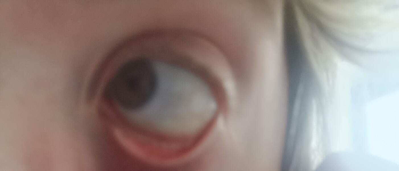 Possible alcohol withdrawral - scared