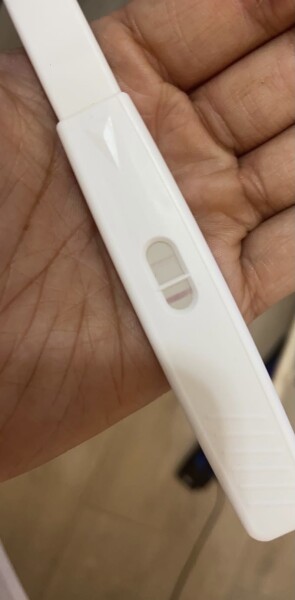 Failed abortion- now 22 weeks.