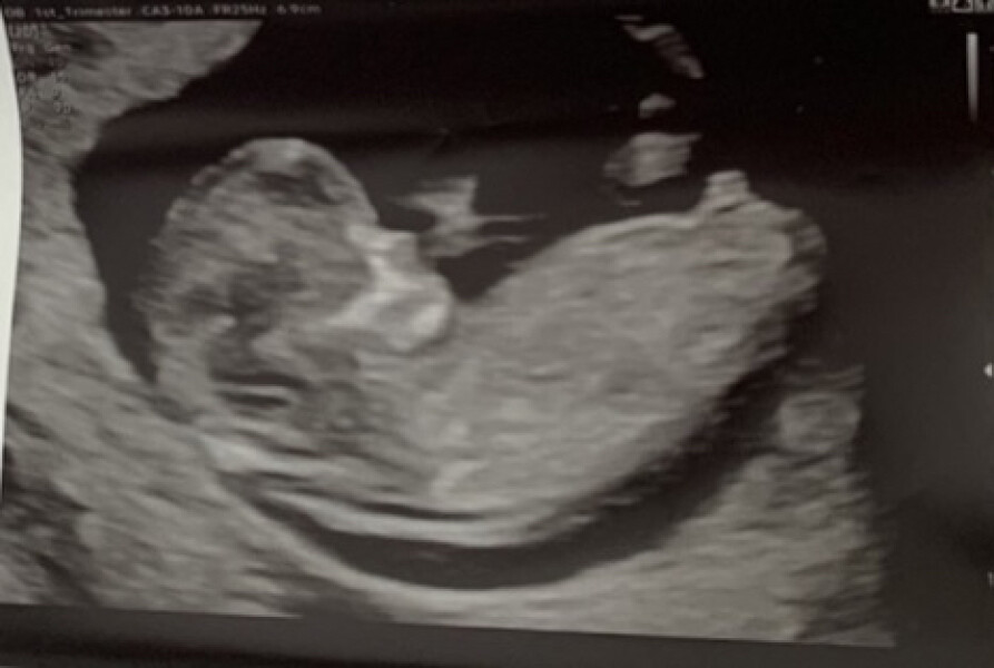 Due December 2022 thread 3