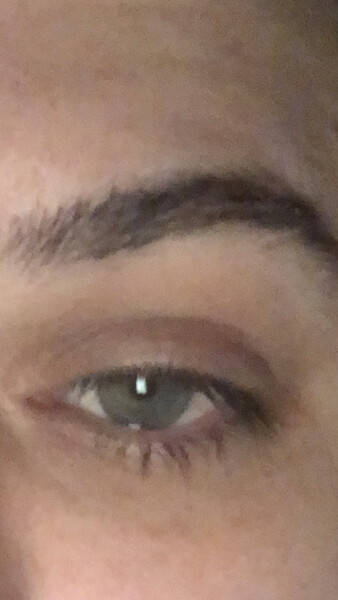 What colour is this eye?