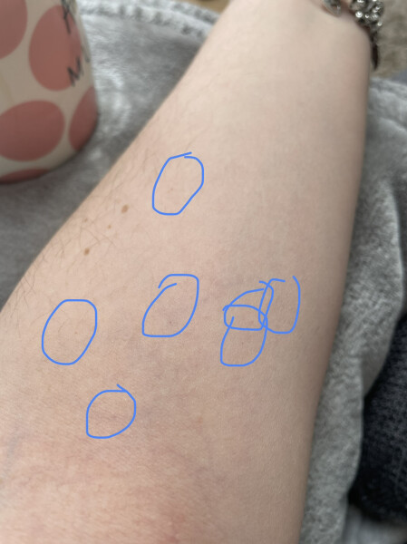 Tiny red spots on arms