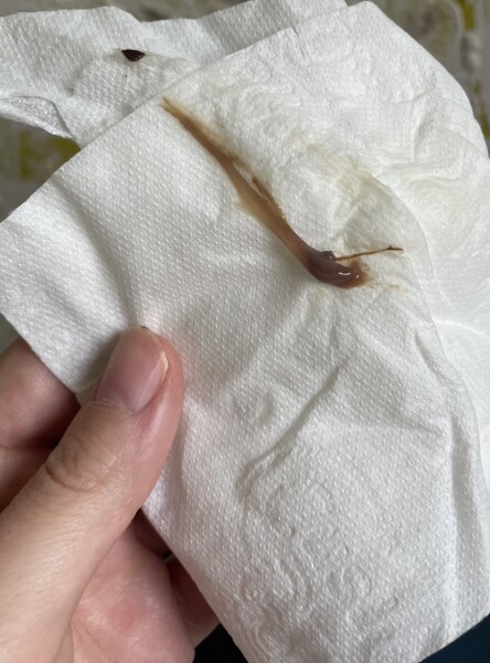 Sorry for the pic but wtf is that !!