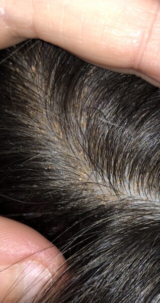 Not quite sporn but almost as gross!