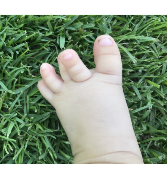 Is this an abnormal set up of toes (pic included)?