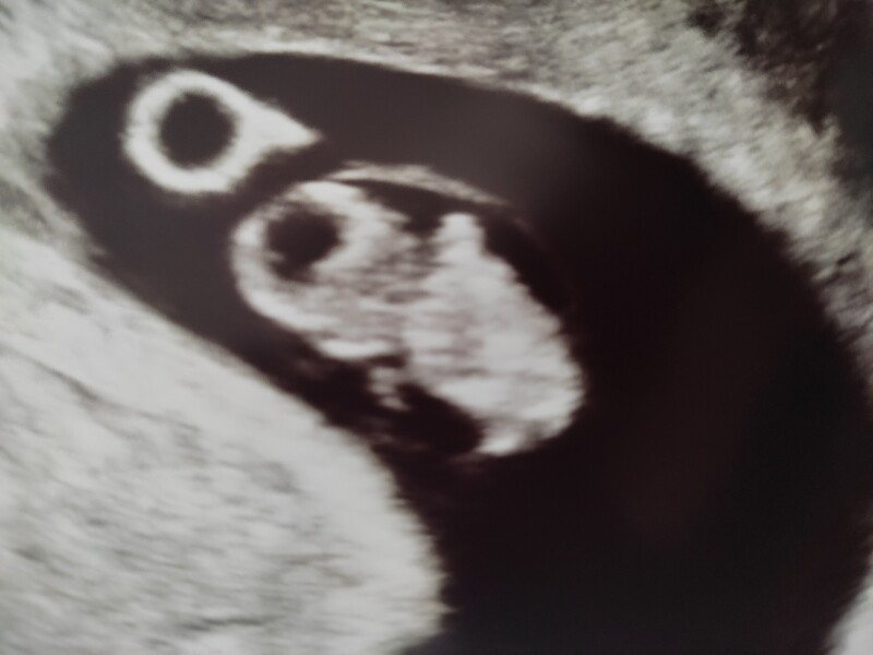 Due February 2023 ❤️💙💛💖