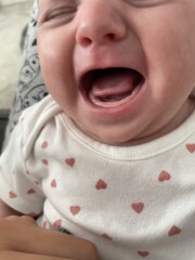 Tongue tie?
