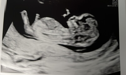 Due Jan 2023
