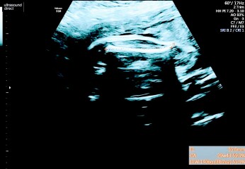 Gender guesses 💗💙💗💙