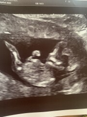 Boy or Girl? 