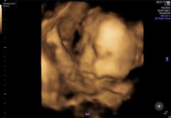 Gender guesses 💗💙💗💙
