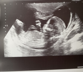 Boy or girl?! 14+1
