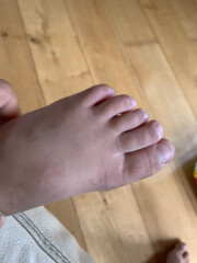 Is this an abnormal set up of toes (pic included)?