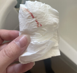 Bleeding 22 weeks