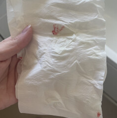 Bleeding 22 weeks