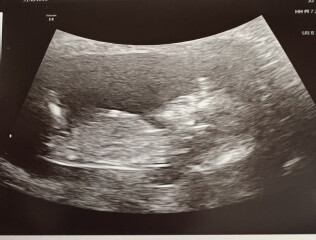 Temptation to find out gender! Help