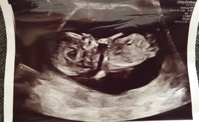 Due December 2022 thread 3