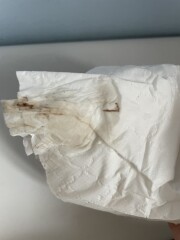Could this be implantation bleeding 