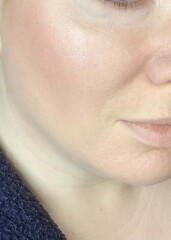 Skin & Me reviews?