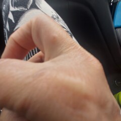 What on earth is biting me? Such pain!