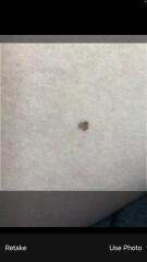 Mole