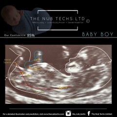 Nub theory : One said boy One said girl? What do we think?
