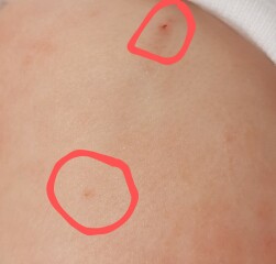 Vaccine holes